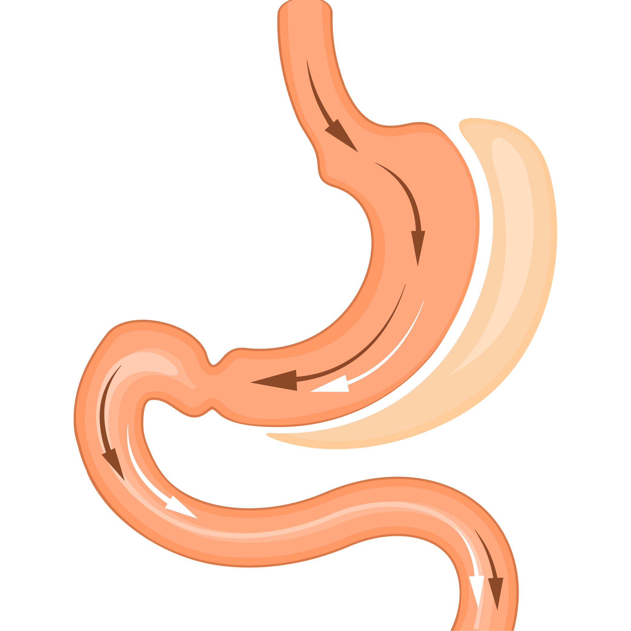 Copy of gastric sleeve